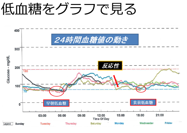 低血糖症とは